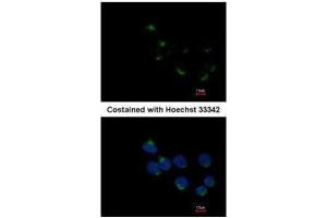 ICC/IF Image Immunofluorescence analysis of methanol-fixed A431, using GALNT6, antibody at 1:200 dilution. (GALNT6 antibody)