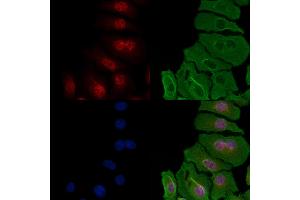ABIN6257259 and ABIN6274296 staining Hela cells by IF/ICC. (HNRNPH1 antibody  (Internal Region))