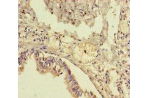 Immunohistochemistry of paraffin-embedded human lung tissue using ABIN7173257 at dilution of 1:100