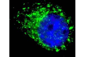 Fluorescent ige of  cells stained with G8a/b (M1LC3A/B) antibody. (MAP1LC3A/B antibody  (cleaved))