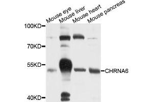 Western blot analysis of extracts of various cells, using CHRNA6 antibody. (CHRNA6 antibody)