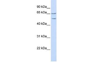 Western Blotting (WB) image for anti-Tweety Homolog 1 (TTYH1) antibody (ABIN2458855) (TTYH1 antibody)