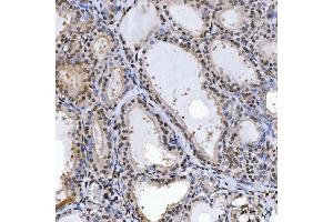 IHC analysis of SPT5/SUPT5H using anti-SPT5/SUPT5H antibody (ABIN7601985). (SUPT5H antibody  (AA 533-1087))