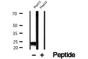 Western blot analysis of extracts of HepG2 cells, using RAB14 antibody. (RAB14 antibody  (C-Term))