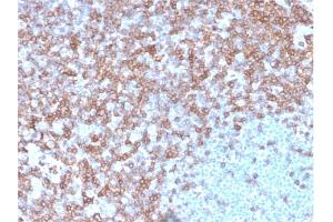 Formalin-fixed, paraffin-embedded human spleen stained with CD43 Mouse Monoclonal Antibody (SPN/3388).