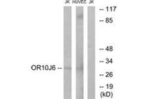 Western blot analysis of extracts from Jurkat/HuvEc cells, using OR10J6 Antibody. (OR10J6P antibody  (AA 227-276))