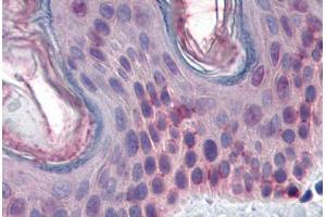 Human Skin: Formalin-Fixed, Paraffin-Embedded (FFPE) (STK16 antibody  (AA 1-306))