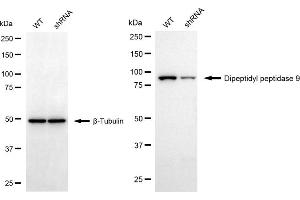 Western blotting analysis using dipeptidyl peptidase 9 antibody (ABIN7798348).