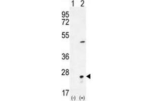 Western blot analysis of VSNL1 (arrow) using rabbit polyclonal VSNL1 Antibody (Center) . (VSNL1 antibody  (Middle Region))