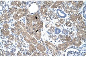 Human kidney (ST3GAL5 antibody  (N-Term))
