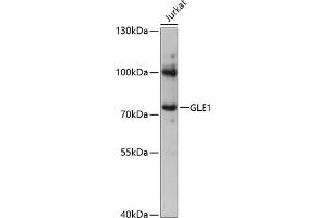 Western blot analysis of extracts of Jurkat cells, using GLE1 antibody (ABIN6131944, ABIN6141122, ABIN6141124 and ABIN6217119) at 1:3000 dilution. (GLE1 antibody  (AA 1-300))