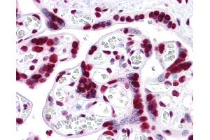 Anti-HMGB1 antibody IHC of human placenta. (HMGB1 antibody  (AA 1-216))