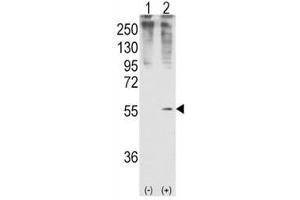 Western blot analysis of GDF11 antibody and 293 cell lysate (2 ug/lane) either nontransfected (Lane 1) or transiently transfected with the GDF11 gene (2). (GDF11 antibody  (AA 32-61))