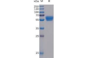 Human 4-1BB Ligand Protein, mFc-His Tag on SDS-PAGE under reducing condition. (TNFSF9 Protein (mFc-His Tag))