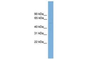 Image no. 1 for anti-Glucosidase, Beta, Acid 3 (Cytosolic) (GBA3) (AA 71-120) antibody (ABIN6745153) (GBA3 antibody  (AA 71-120))