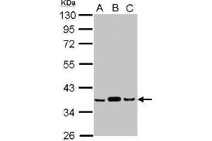 WB Image Sample (30 ug of whole cell lysate) A: A549 B: H1299 C: HCT116 10% SDS PAGE antibody diluted at 1:1000