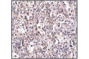 Immunohistochemistry of SCARB1 in human spleen tissue with this product at 2. (SCARB1 antibody  (N-Term))