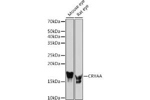 Western blot analysis of extracts of various cell lines, using CRYAA Rabbit mAb (ABIN7266527) at 1:1000 dilution. (CRYAA antibody)