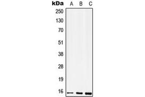 Western blot analysis of CD52 expression in THP1 (A), mouse spleen (B), H9C2 (C) whole cell lysates. (CD52 antibody  (N-Term))