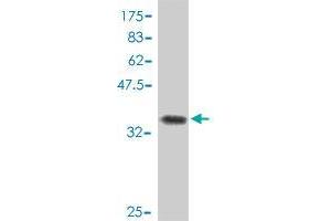 Western Blot detection against Immunogen (37. (CNOT7 antibody  (AA 1-100))