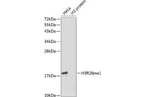 Western blot analysis of extracts of various cell lines, using MonoMethyl-Histone H3-R26 antibody (ABIN3017500, ABIN3017501, ABIN3017502 and ABIN6220121). (Histone 3 antibody  (H3R26me))