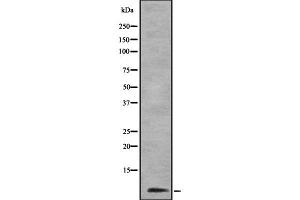 Western blot analysis of Cytochrome c Oxidase 6B1 using COLO205 whole cell lysates (COX6B1 antibody  (Internal Region))