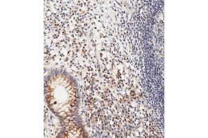 Immunohistochemical analysis of paraffin-embedded human epityphlon tissue using (ABIN1981278 and ABIN2845115) performed on the Leica® BOND RXm. (CDKN2A antibody  (C-Term))