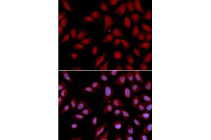 Immunofluorescence analysis of U2OS cells using DLGAP5 antibody (ABIN5971223). (DLGAP5 antibody)