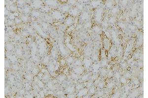 ABIN6272567 at 1/100 staining Mouse kidney tissue by IHC-P. (CYP11B2 antibody  (Internal Region))