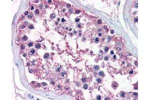 Immunohistochemical (Formalin/PFA-fixed paraffin-embedded sections) staining in human testis with NR0B1 polyclonal antibody . (NR0B1 antibody)
