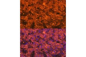 Immunofluorescence (IF) image for anti-alpha-2-Macroglobulin (A2M) antibody (ABIN7265558)