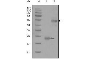 Western blot analysis using CD44 mouse mAb against truncated Trx-CD44 recombinant protein (1) and GST-CD44 (aa628-699) recombinant protein (2). (CD44 antibody)