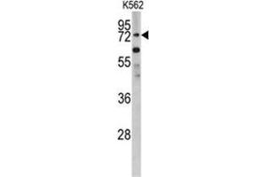 Western blot analysis of PLZF antibody (C-term) in K562 cell line lysates (35ug/lane).