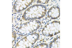 Immunohistochemistry of paraffin-embedded human colon using GNE antibody at dilution of 1:100 (x40 lens). (GNE antibody)