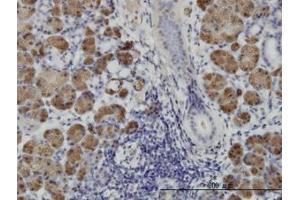 Image no. 1 for anti-Homeodomain Interacting Protein Kinase 1 (HIPK1) (AA 330-430) antibody (ABIN466275) (HIPK1 antibody  (AA 330-430))