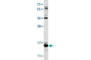 Western blot analysis of NCI-H460 cell lysate (35 ug/lane) with RCAN2 polyclonal antibody .