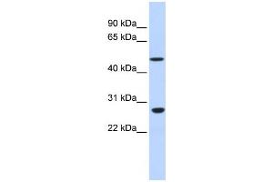 Western Blotting (WB) image for anti-Zinc Finger Protein 556 (ZNF556) antibody (ABIN2458203) (ZNF556 antibody)