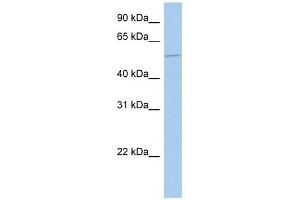 ALG1 antibody used at 1 ug/ml to detect target protein. (ALG1 antibody  (N-Term))