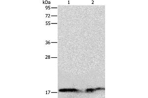 Western blot analysis of Human normal liver and fetal liver tissue, using ANG Polyclonal Antibody at dilution of 1:133 (ANG antibody)
