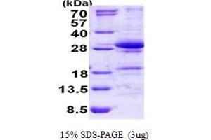 DiGeorge Syndrome Critical Region Gene 6-Like (DGCR6L) (AA 1-220) protein (His tag)