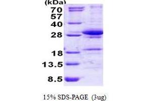 SDS-PAGE (SDS) image for DiGeorge Syndrome Critical Region Gene 6-Like (DGCR6L) (AA 1-220) protein (His tag) (ABIN5778667) (DGCR6L Protein (AA 1-220) (His tag))
