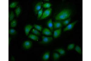 Immunofluorescence staining of A549 cells with ABIN7151176 at 1:266, counter-stained with DAPI. (RNF213 antibody  (AA 202-350))