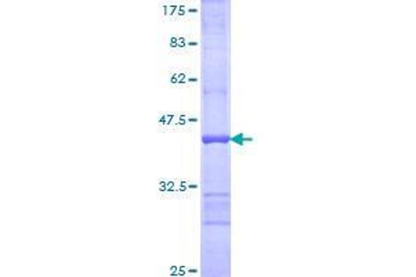 UBE2J1 Protein (AA 9-118) (GST tag)