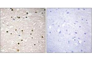 Immunohistochemistry analysis of paraffin-embedded human brain tissue, using p73 Antibody. (Tumor Protein p73 antibody  (AA 271-320))