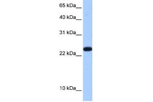 WB Suggested Anti-C19orf24 Antibody Titration:  0. (C19orf24 antibody  (N-Term))