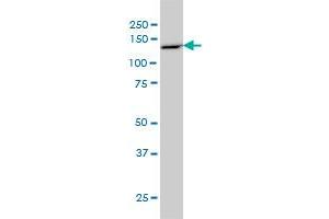 PCDH8 monoclonal antibody (M01), clone 6A8 Western Blot analysis of PCDH8 expression in COLO 320 HSR . (Protocadherin 8 antibody  (AA 32-120))