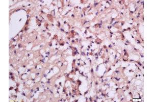 Formalin-fixed and paraffin embedded rat brain tissue labeled with Anti-MSRB2 Polyclonal Antibody, Unconjugated  at 1:300 followed by conjugation to the secondary antibody and DAB staining (MSRB2 antibody  (AA 31-130))