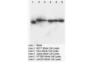 Image no. 1 for anti-Deoxynucleotidyltransferase, terminal (DNTT) (C-Term) antibody (ABIN1493121) (TdT antibody  (C-Term))