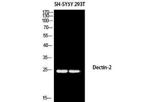 Western Blot (WB) analysis of SH-SY5Y 293T using Dectin-2 antibody. (C-Type Lectin Domain Family 6, Member A (CLEC6A) antibody)