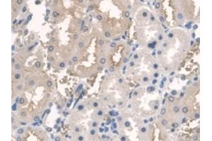 Detection of ARNTL in Rat Kidney Tissue using Polyclonal Antibody to Aryl Hydrocarbon Receptor Nuclear Translocator Like Protein (ARNTL) (ARNTL antibody  (AA 1-169))